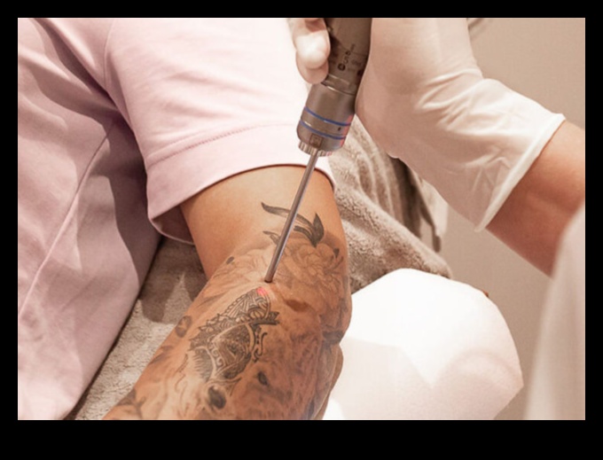 Precīzijas adatas: vismodernāko tetovēšanas metožu izpēte
