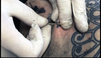 Precīzijas adatas: vismodernāko tetovēšanas metožu izpēte